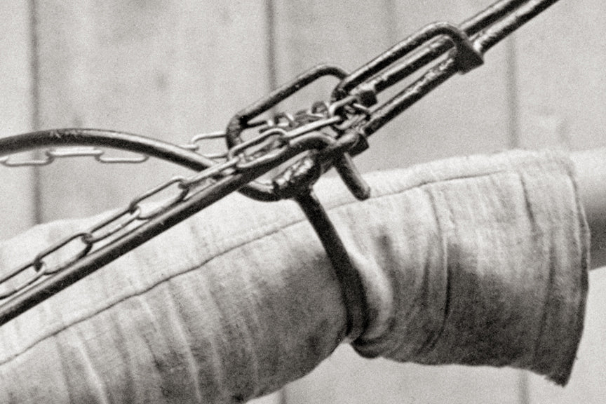 Broken Arm, Red Cross Arm Splint Photo, 1918 Historical Pix