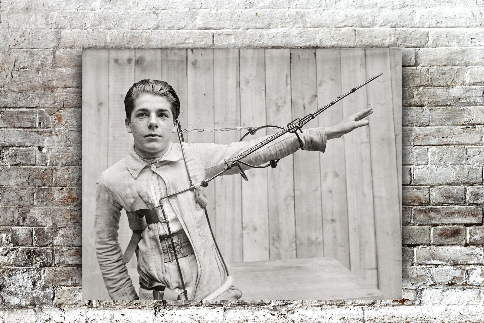 Broken Arm, Red Cross Arm Splint Photo, 1918 Historical Pix