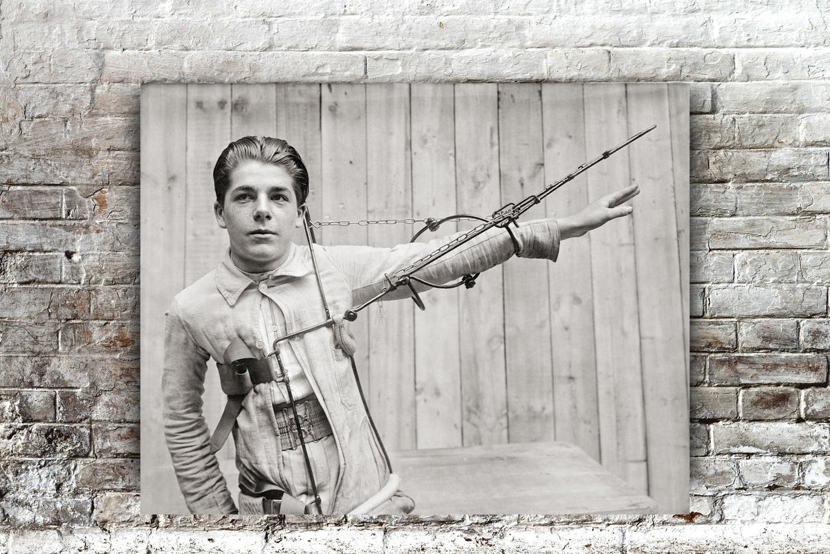 Broken Arm, Red Cross Arm Splint Photo, 1918 Historical Pix