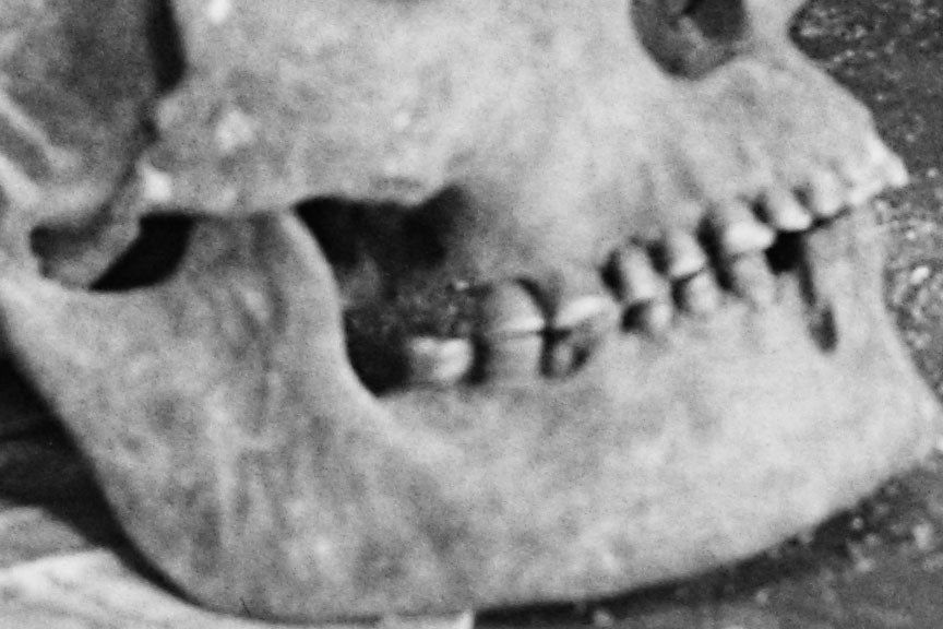 Scientist Examining Skulls, 1940s Historical Pix